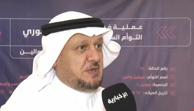 ما أسباب سرعة إجراءات عمليات فصل التوائم السيامية؟.. مسؤول يوضح