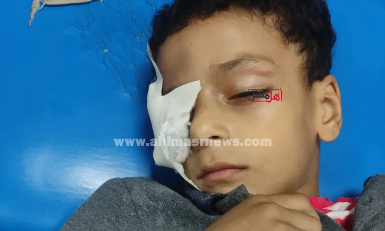 استبعاد مدير ووكلاء مدرسة بنجع حمادي وإحالتهم للتحقيق بعد إصابة تلميذ وفقدانه إحدى عينيه