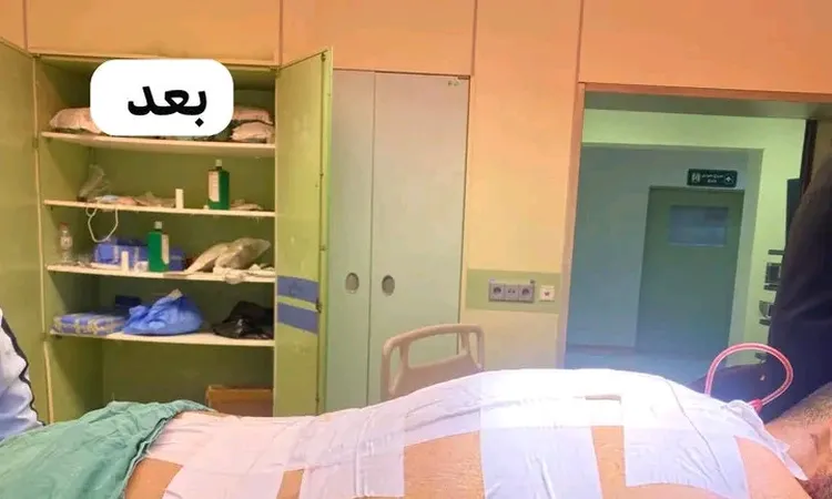 أطباء كفر الشيخ الجامعي يجرون عملية معقدة لتشوه عمود فقري (تفاصيل)