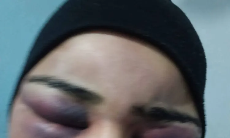 ضبط زوج اعتدى على زوجته بقطعة حديد وأصابها بجروح بالغة في الفيوم