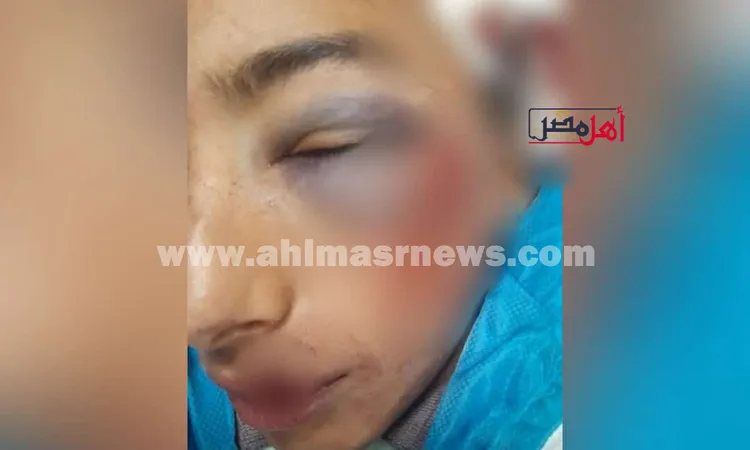 ضرب مبرح لطالب في الصف الأول الإعدادي بالإسماعيلية.. والشرطة تحقق